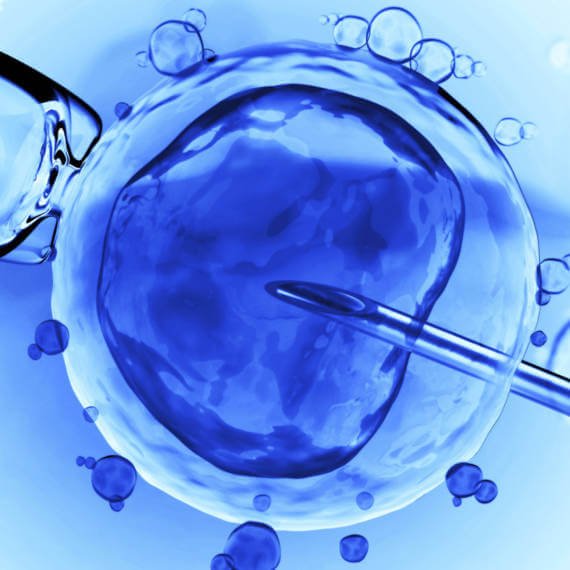 zabieg in vitro