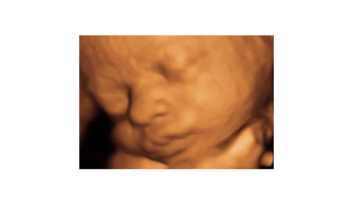 Bezpłatne badania prenatalne w Gamecie w Rzgowie